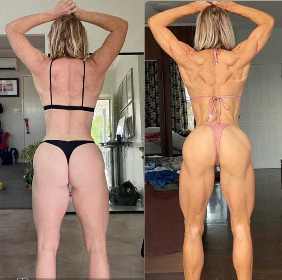 Hailey's transformation